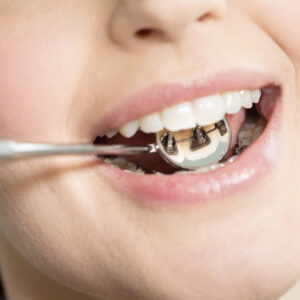 Hampaiden oikomishoito - hammaslääkäri tampere